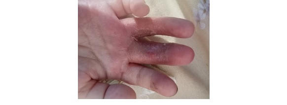 CẢNH BÁO ĐIỆN GIẬT Ở TRẺ NHỎ