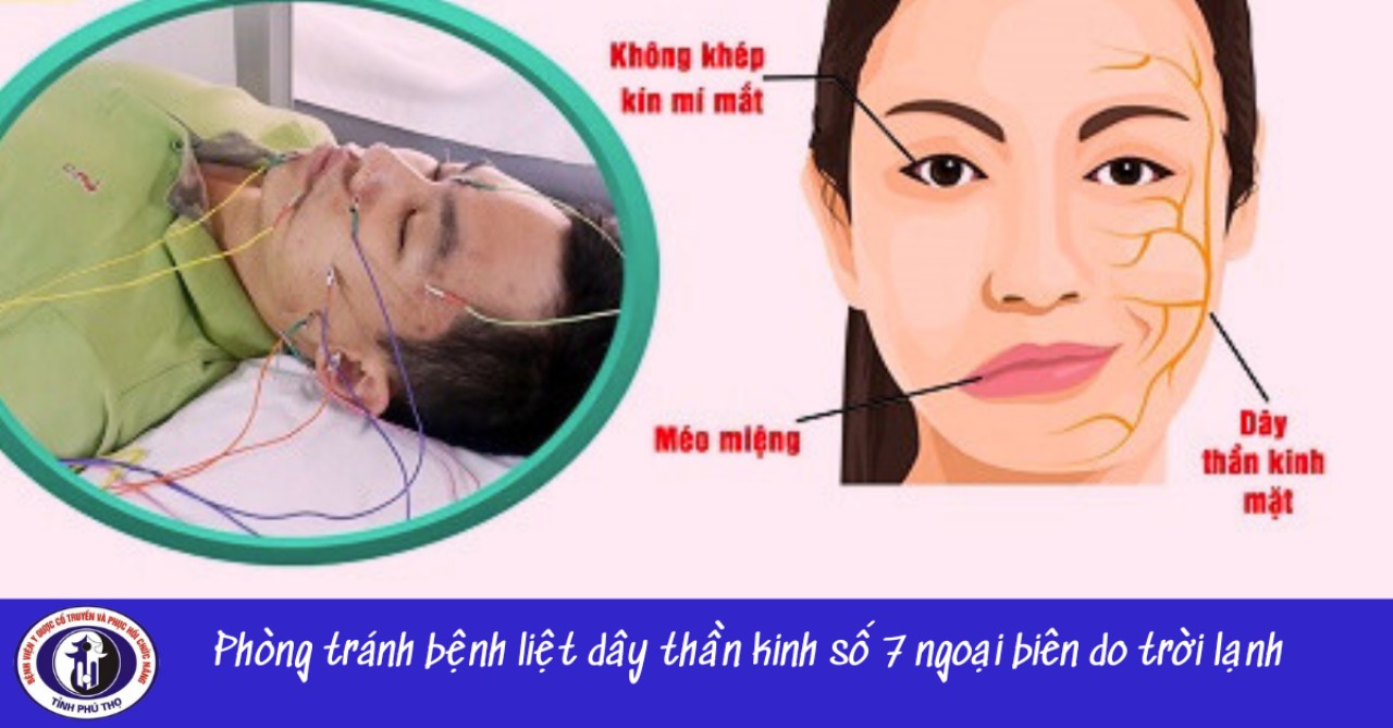 PHÒNG TRÁNH LIỆT DÂY THẦN KINH SỐ 7 DO TRỜI LẠNH