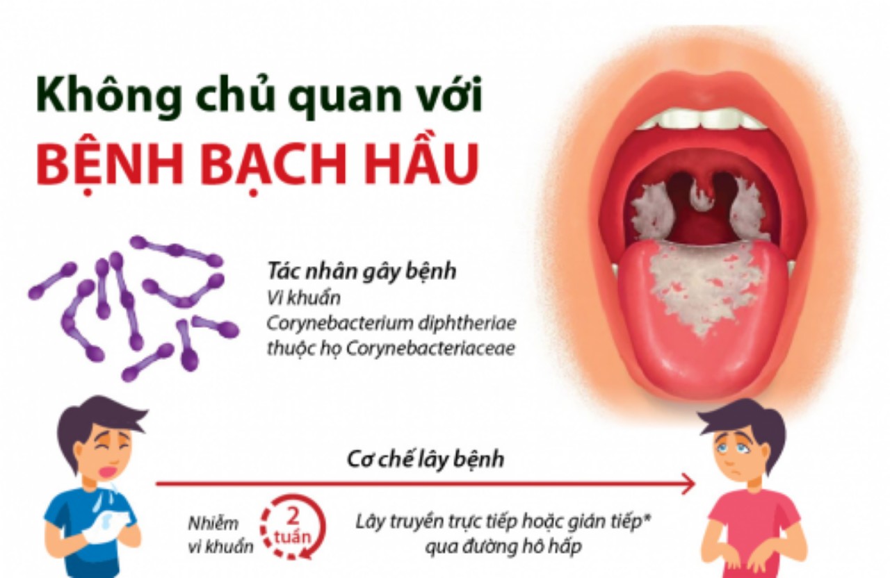 KHÔNG CHỦ QUAN VỚI BỆNH BẠCH HẦU